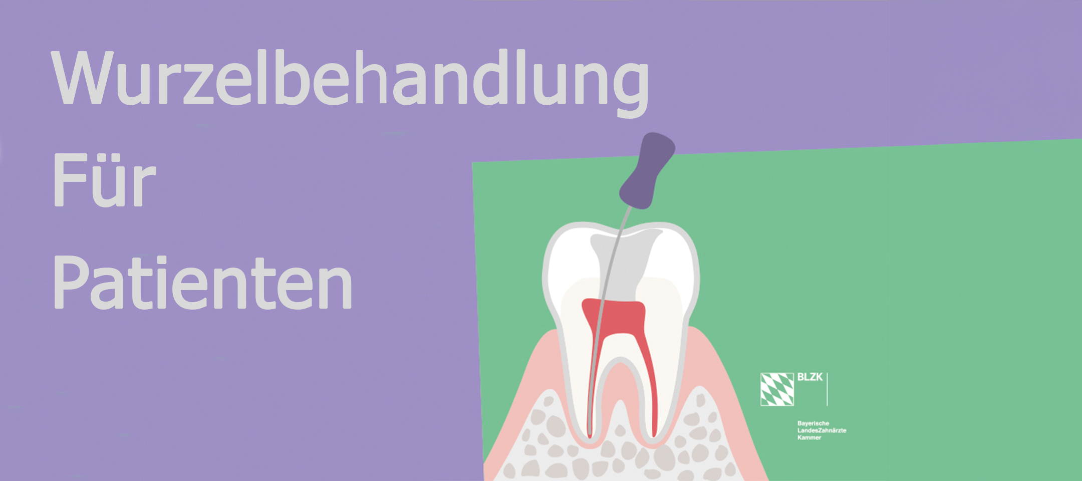 Wurzelbehandlung