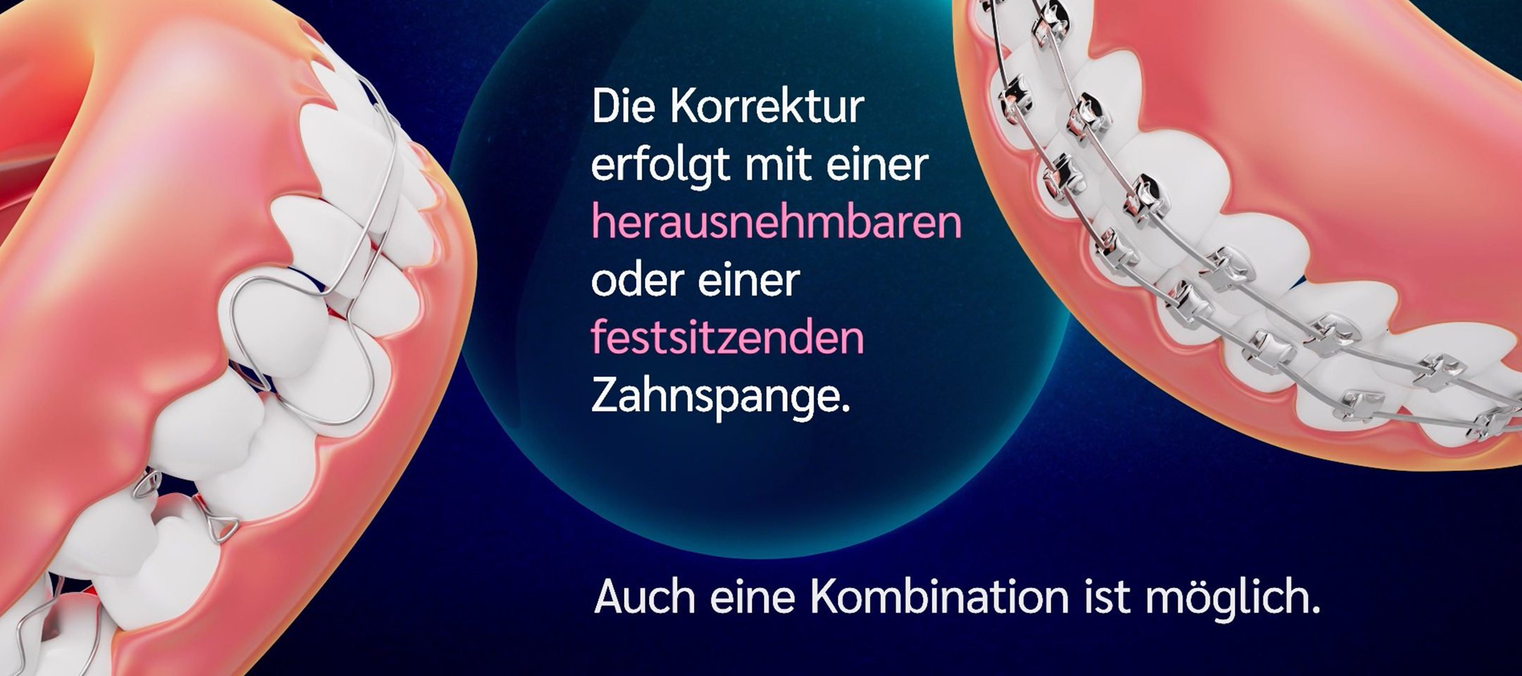 Neuer Film KFO