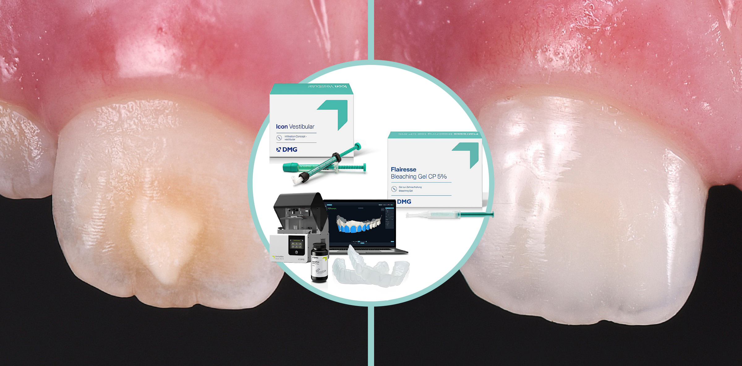 BZB1225_S.72_Teaser_2400x1184