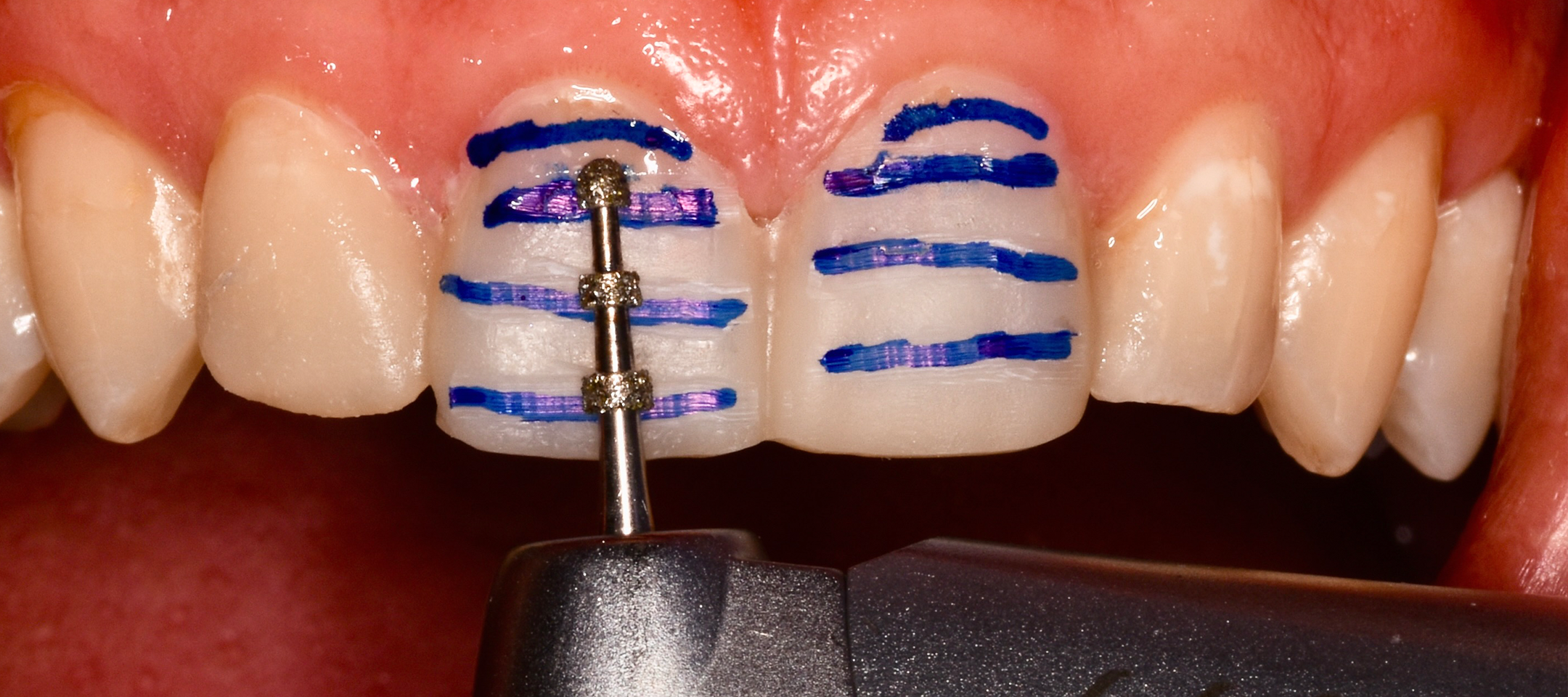 Moderne Praeparationstechniken